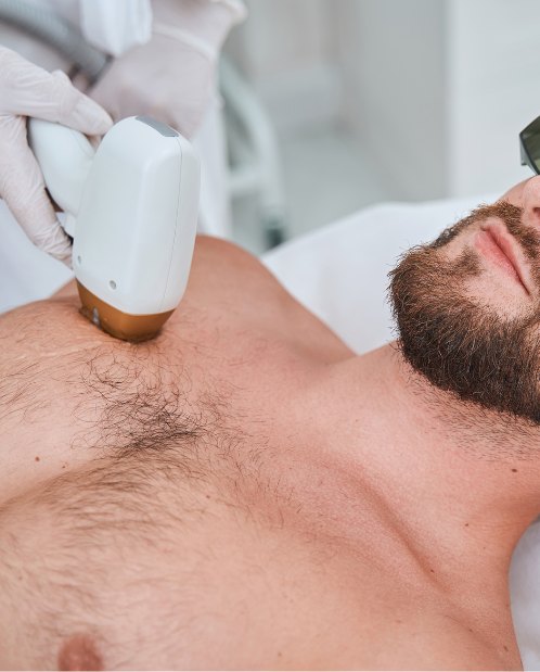 Laser Hair Removal in Indirapuram