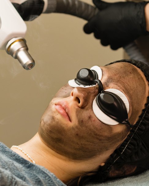 Laser Carbon Peel Treatment in Indrapuram
